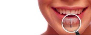 dental impant fiyatları 2020
